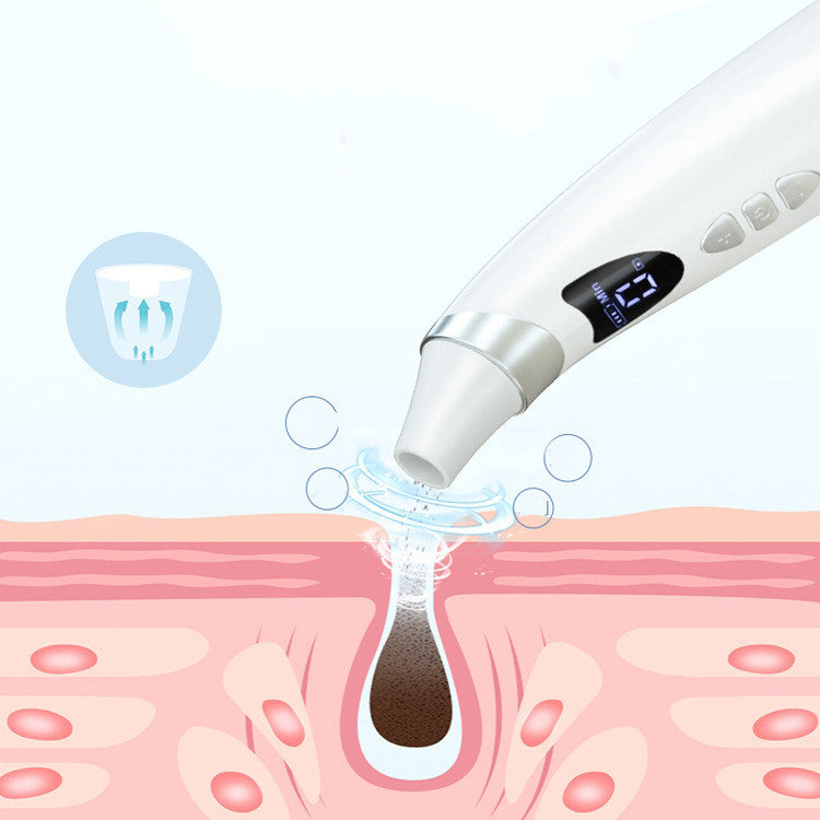 Smart Blackhead Removal Tool with HD Camera